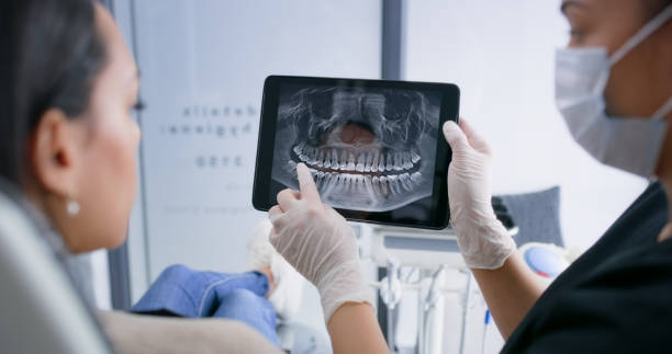 Licensed Wisdom Tooth Removal service in Los Angeles, CA - Smile Center Dentistry